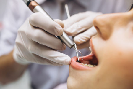 Pentingnya Scaling Gigi dalam Perawatan Kesehatan Gigi dan Gusi